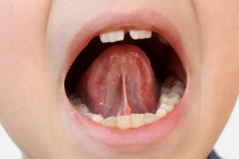 e78a27f57180cdcd70c088e81fc7593a